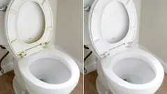 How to remove yellow stains from a toilet seat: this remedy works instantly