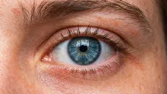 How to lift drooping eyelids? 3 main causes and correction methods